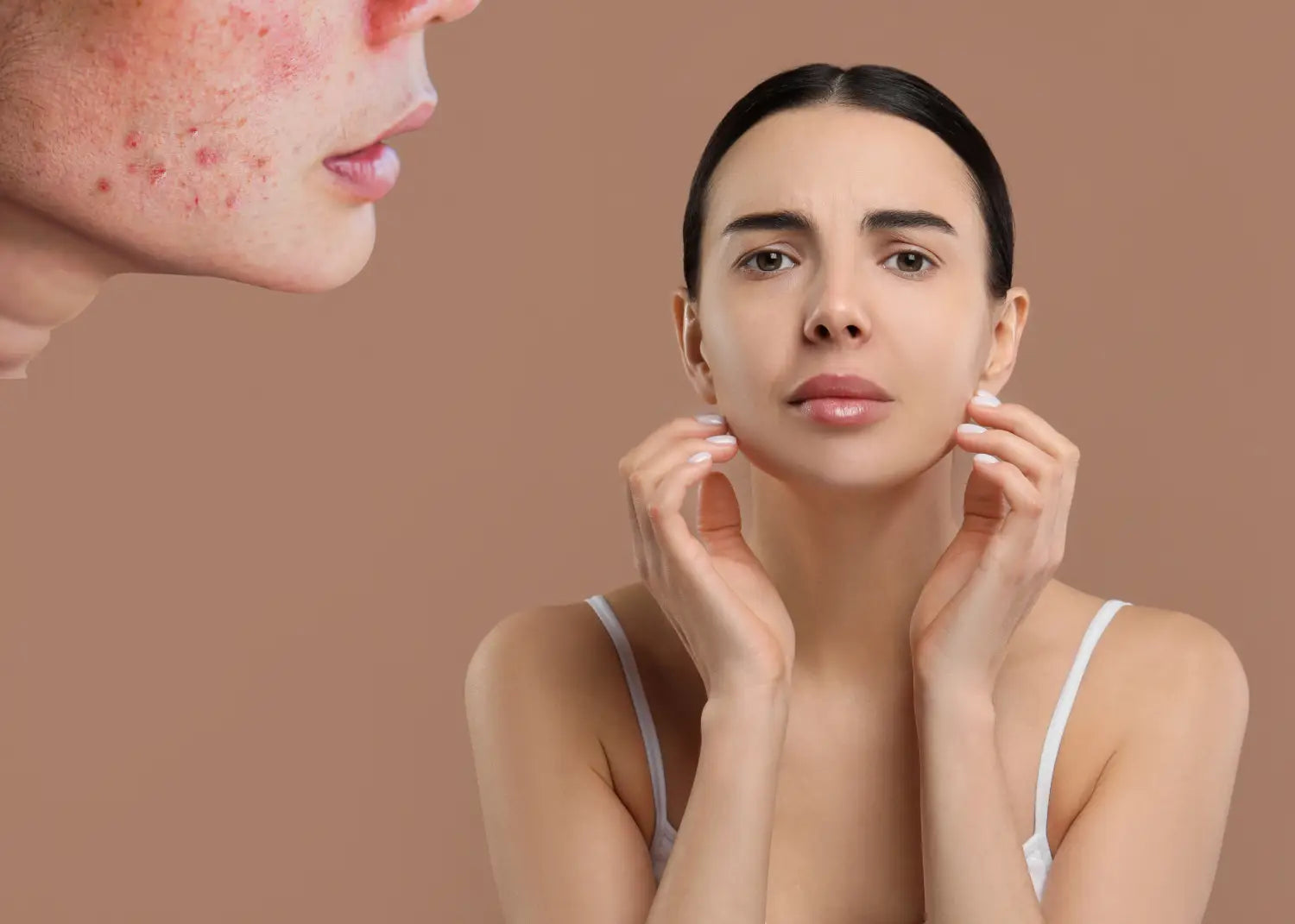¿demasiados productos? Cómo saber si estás sobretratando tu piel
