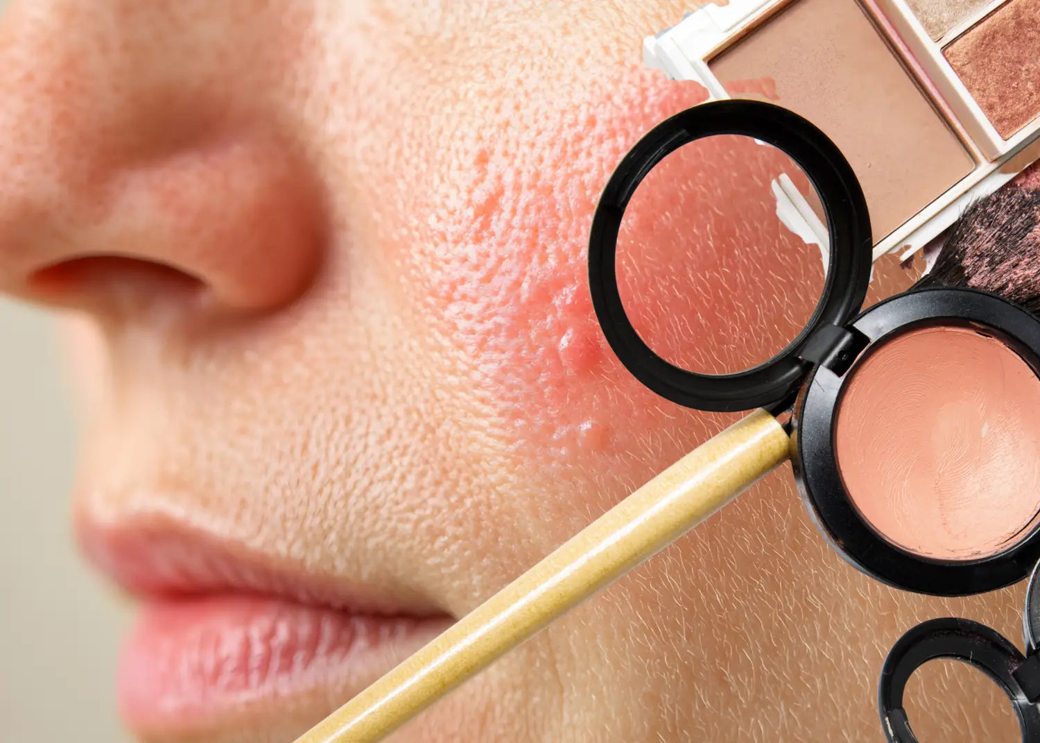 Parabenos en cosmética: qué son para sirven y cuál es su impacto real tu piel