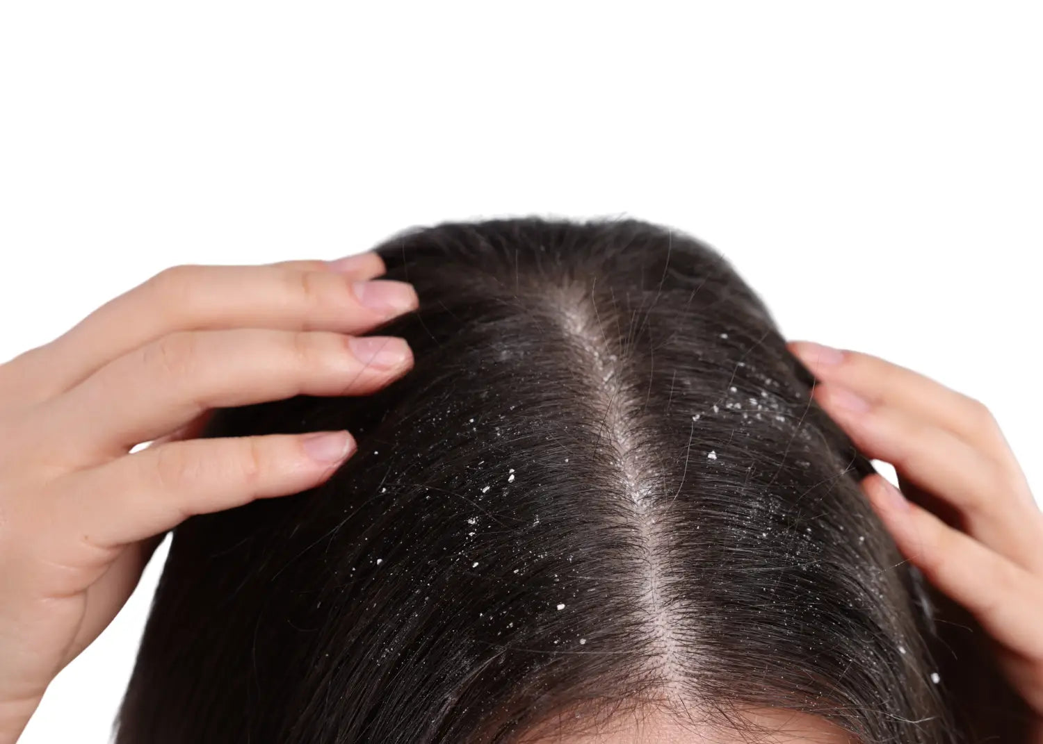 5 problemáticas comunes del cabello y cómo solucionarlas de forma natural